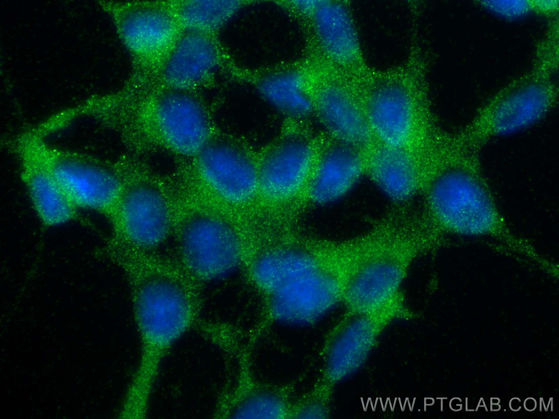 Immunofluorescence (IF) / fluorescent staining of SH-SY5Y cells using PARK7/DJ-1 Polyclonal antibody (11681-1-AP)