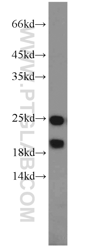 Western Blot (WB) analysis of HeLa cells using PARK7/DJ-1 Polyclonal antibody (11681-1-AP)
