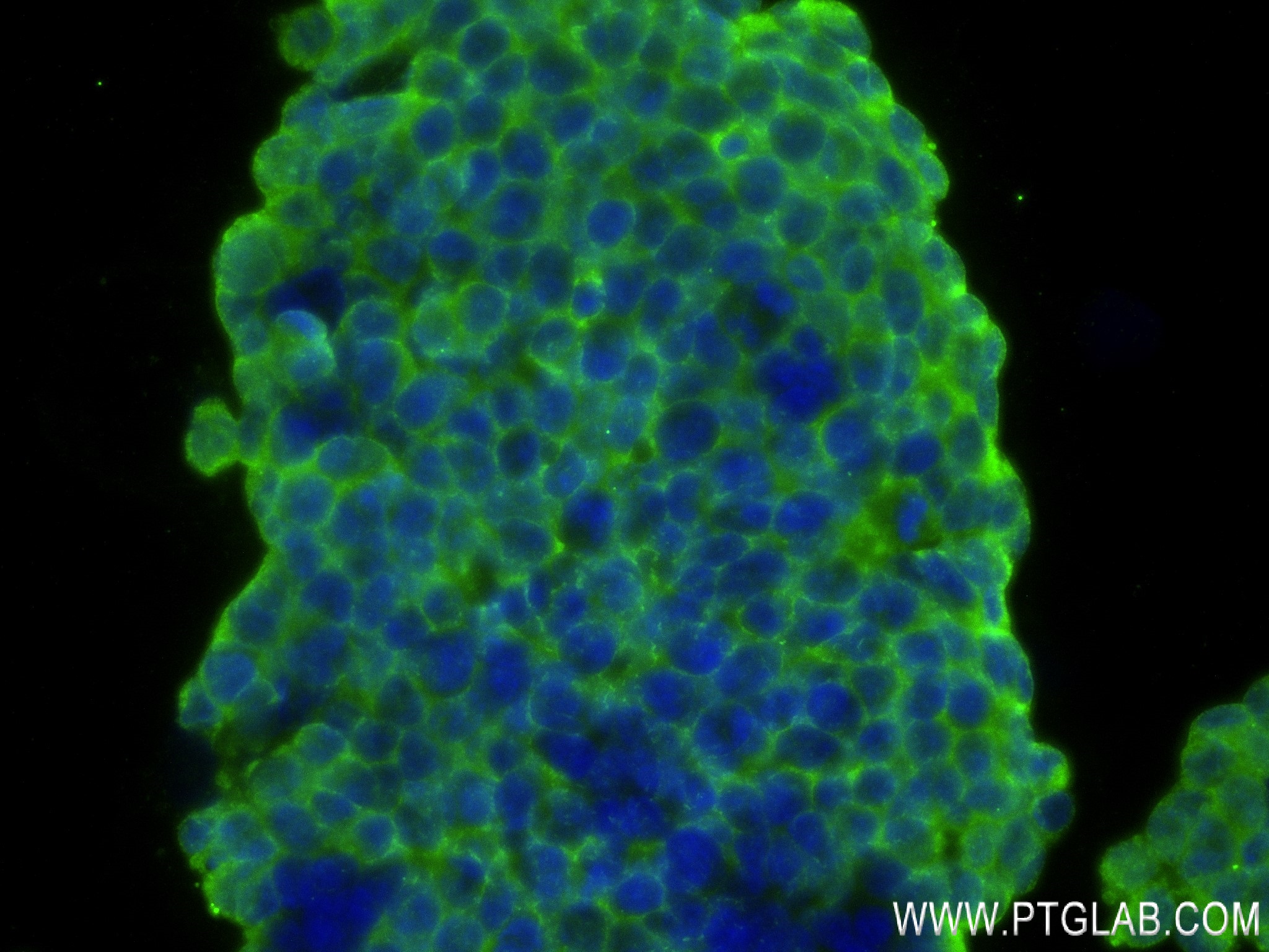 Immunofluorescence (IF) / fluorescent staining of SH-SY5Y cells using PARK7/DJ-1 Recombinant antibody (82913-2-RR)