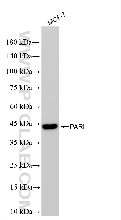 Western Blot (WB) analysis of MCF-7 cells using PARL Recombinant antibody (85167-1-RR)