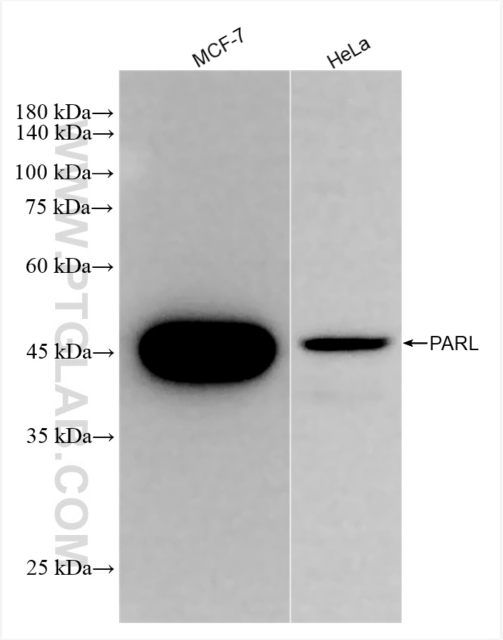 Western Blot (WB) analysis of various lysates using PARL Recombinant antibody (85167-1-RR)