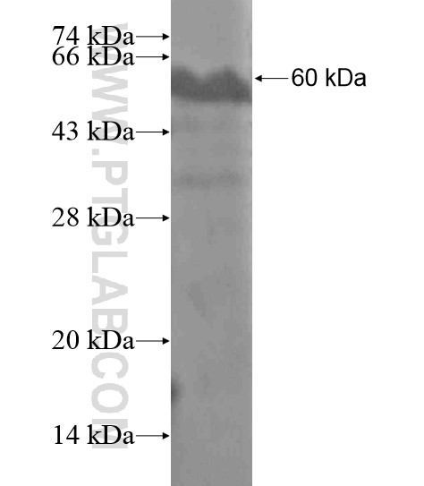 PARM1 fusion protein Ag19992 SDS-PAGE