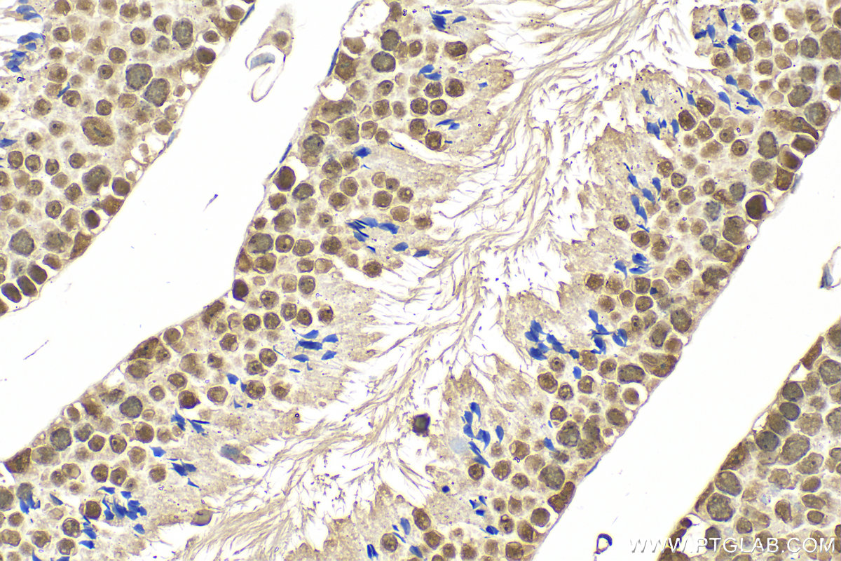 Immunohistochemistry (IHC) staining of mouse testis tissue using PARP1 Polyclonal antibody (13371-1-AP)