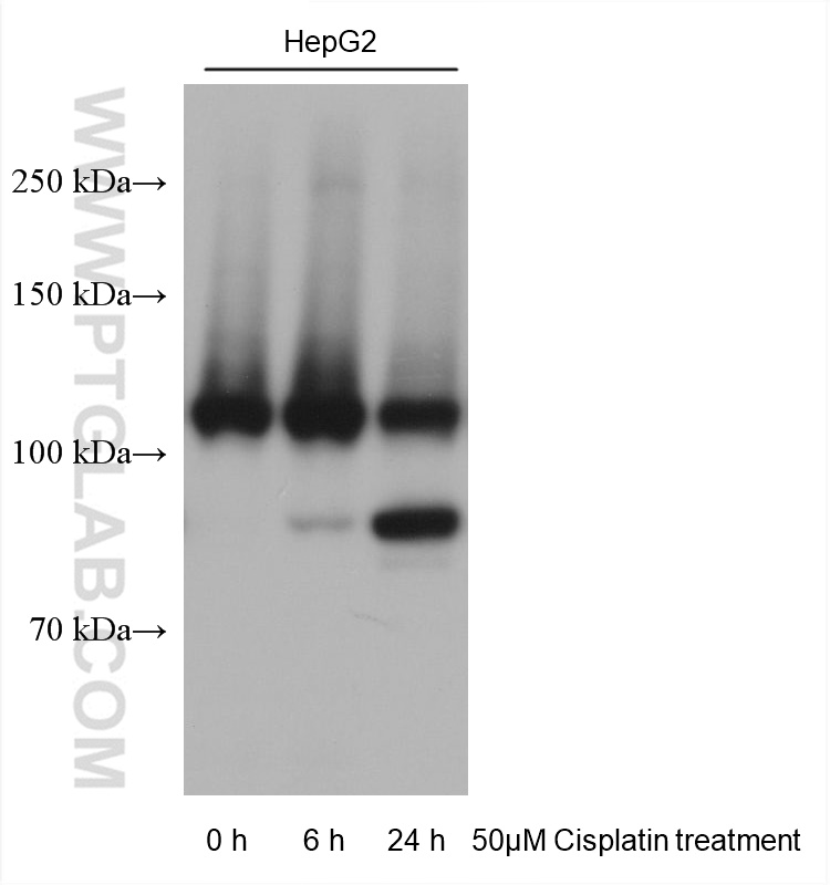 Western Blot (WB) analysis of various lysates using PARP1 Monoclonal antibody (66520-1-Ig)