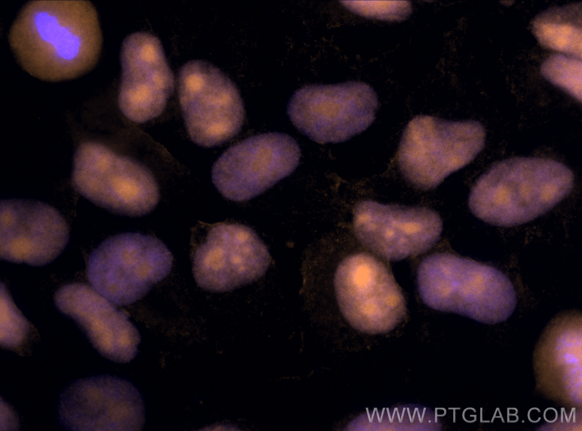 Immunofluorescence (IF) / fluorescent staining of HeLa cells using CoraLite®555-conjugated PARP1 Monoclonal antibody (CL555-66520)