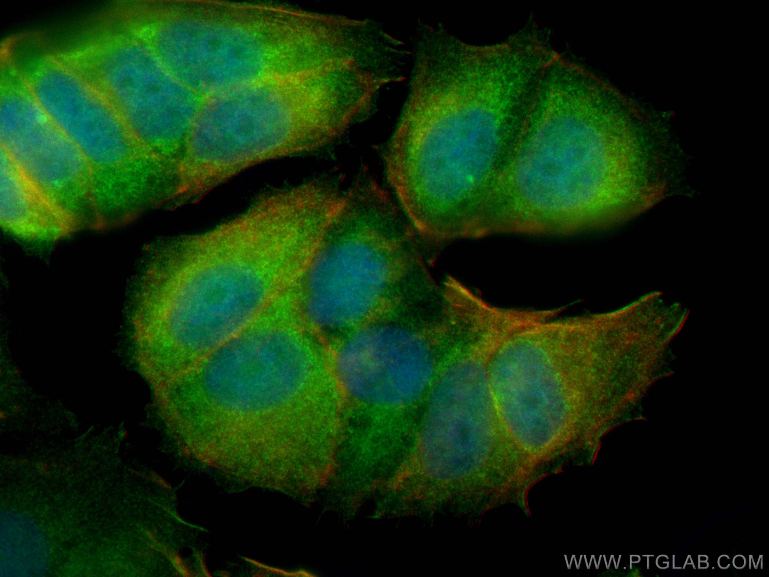 Immunofluorescence (IF) / fluorescent staining of MCF-7 cells using PARP10 Polyclonal antibody (26072-1-AP)