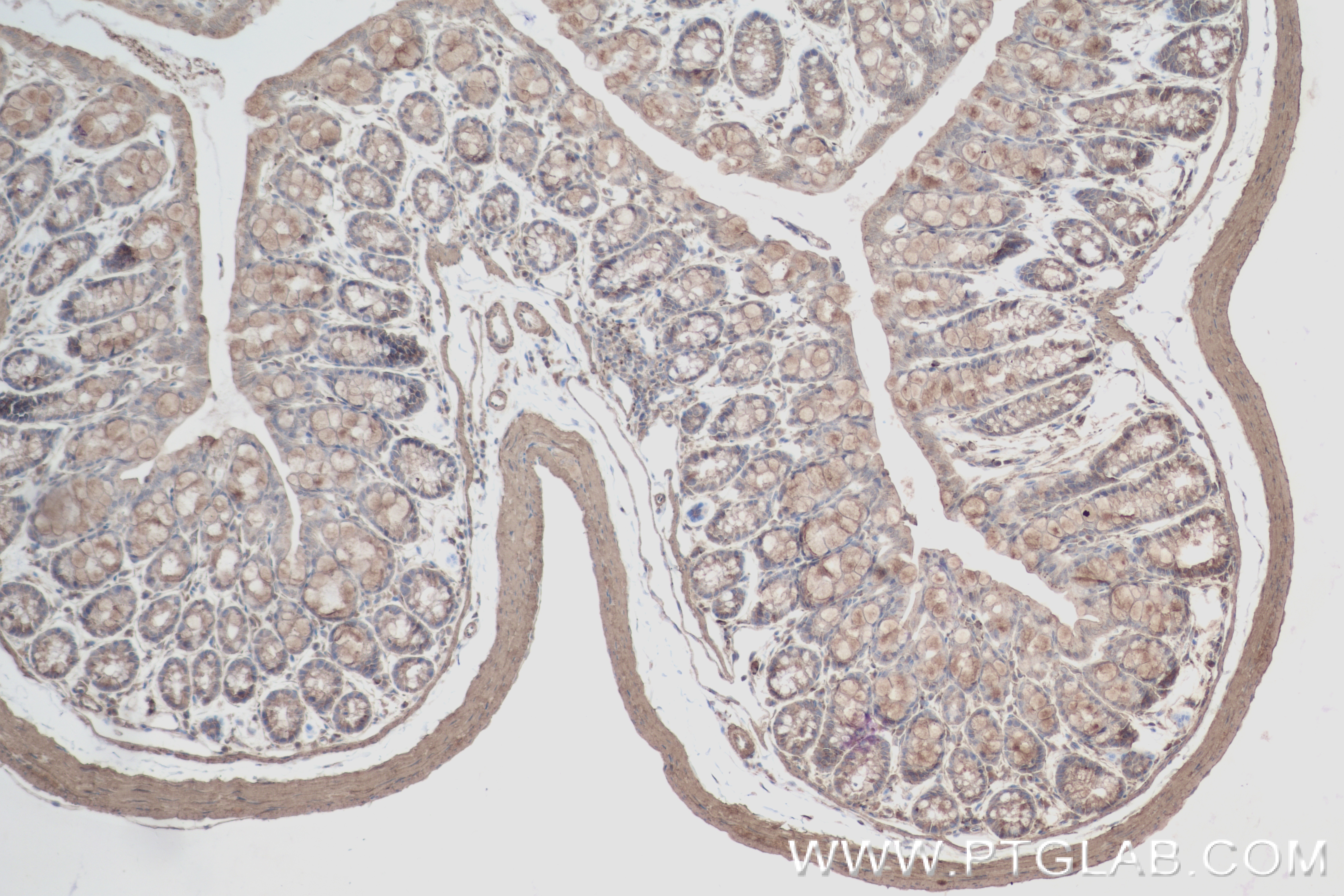 Immunohistochemistry (IHC) staining of mouse colon tissue using PARP14 Recombinant antibody (84039-6-RR)