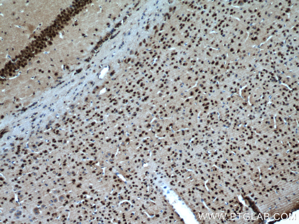 Immunohistochemistry (IHC) staining of mouse brain tissue using PARP2 Polyclonal antibody (20555-1-AP)