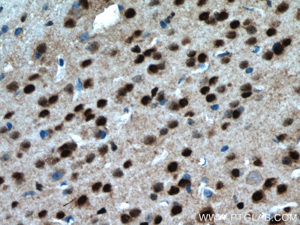 Immunohistochemistry (IHC) staining of mouse brain tissue using PARP2 Polyclonal antibody (20555-1-AP)