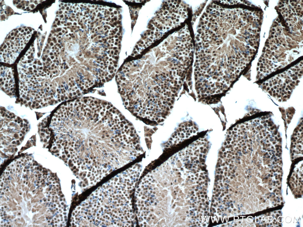 Immunohistochemistry (IHC) staining of mouse testis tissue using PARP2 Polyclonal antibody (20555-1-AP)