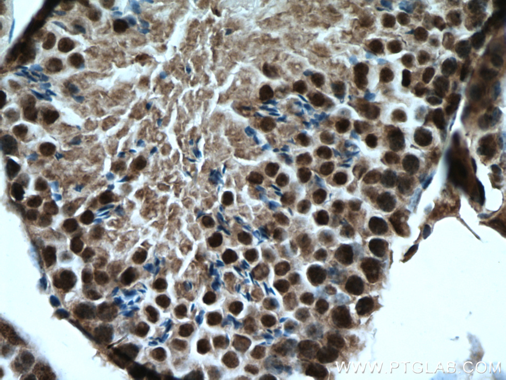 Immunohistochemistry (IHC) staining of mouse testis tissue using PARP2 Polyclonal antibody (20555-1-AP)