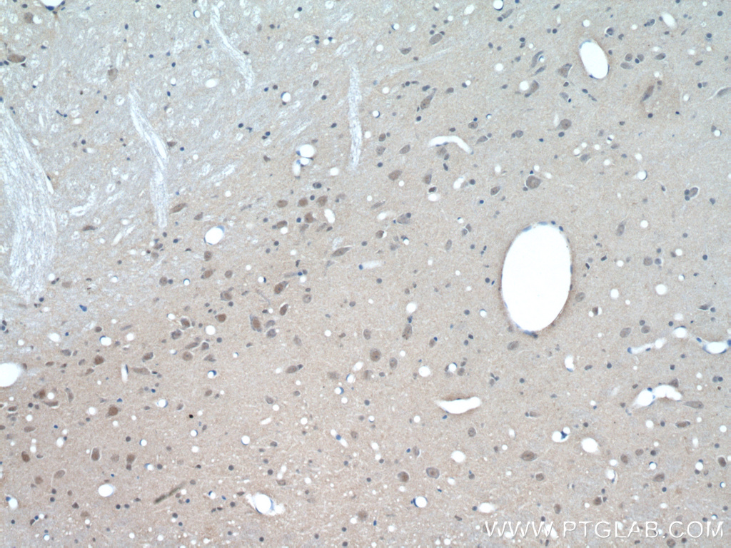 Immunohistochemistry (IHC) staining of rat brain tissue using PARP2 Polyclonal antibody (20555-1-AP)