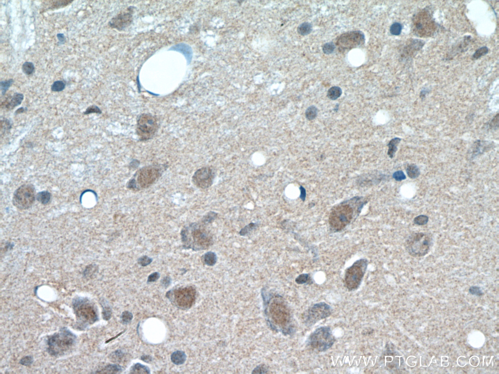 Immunohistochemistry (IHC) staining of rat brain tissue using PARP2 Polyclonal antibody (20555-1-AP)