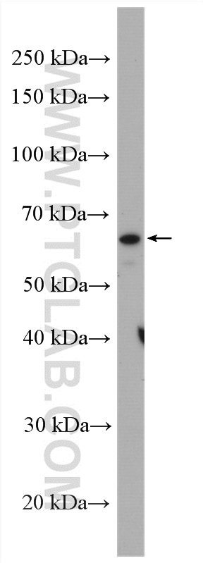 Western Blot (WB) analysis of mouse testis tissue using PARP2 Polyclonal antibody (20555-1-AP)