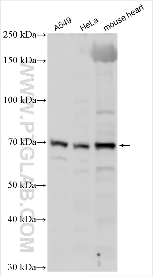 Western Blot (WB) analysis of various lysates using PARP2 Polyclonal antibody (20555-1-AP)