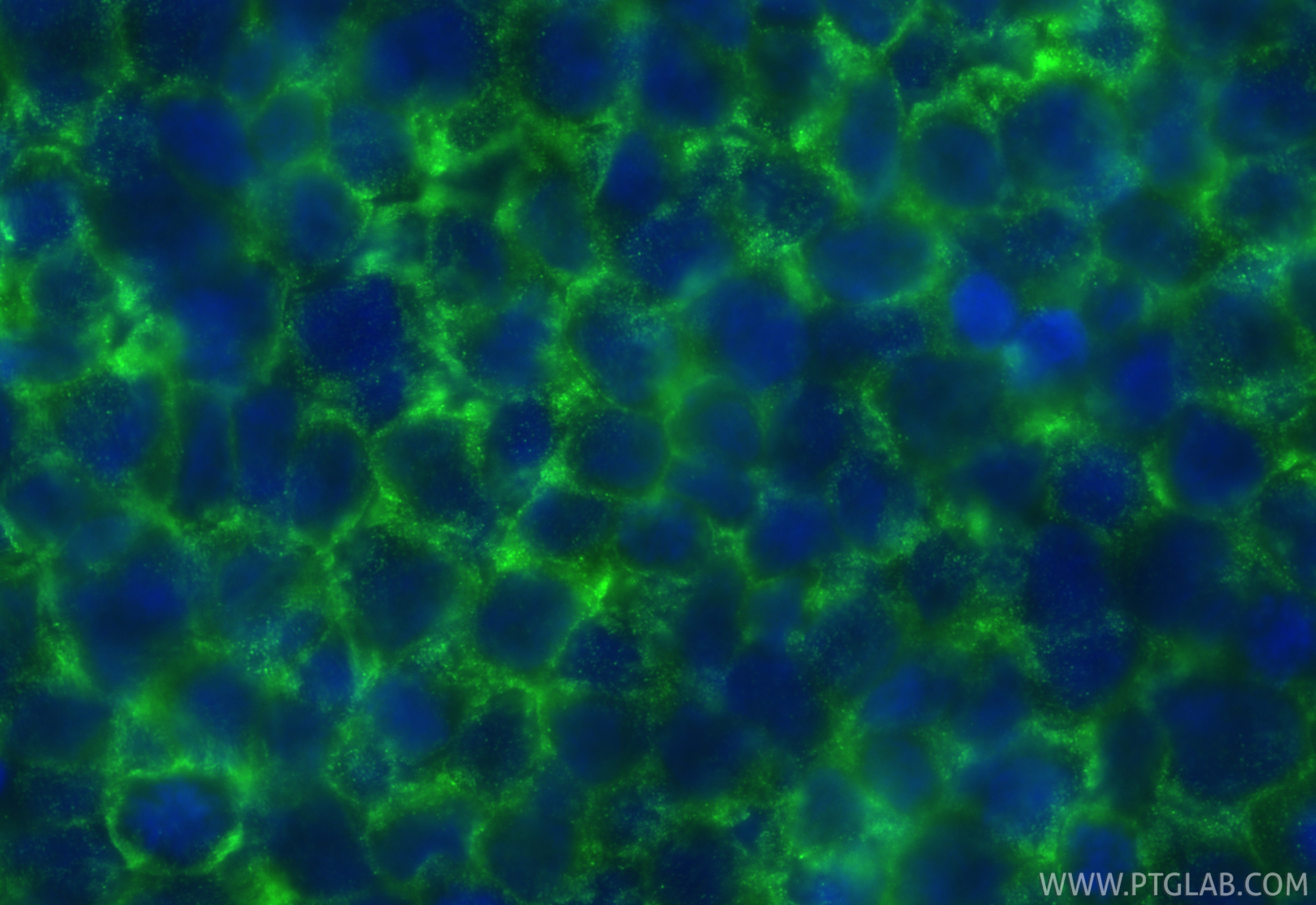 Immunofluorescence (IF) / fluorescent staining of THP-1 cells using PARP9 Polyclonal antibody (17535-1-AP)