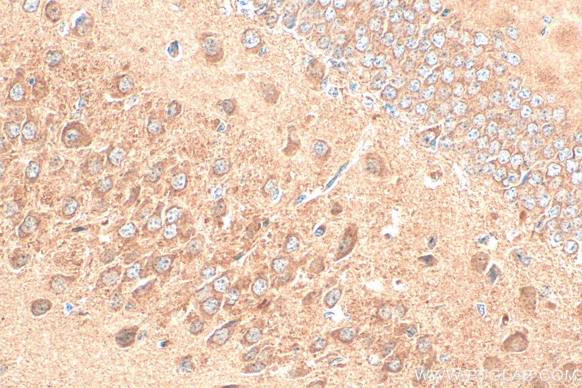 Immunohistochemistry (IHC) staining of mouse brain tissue using PARP9 Polyclonal antibody (17535-1-AP)