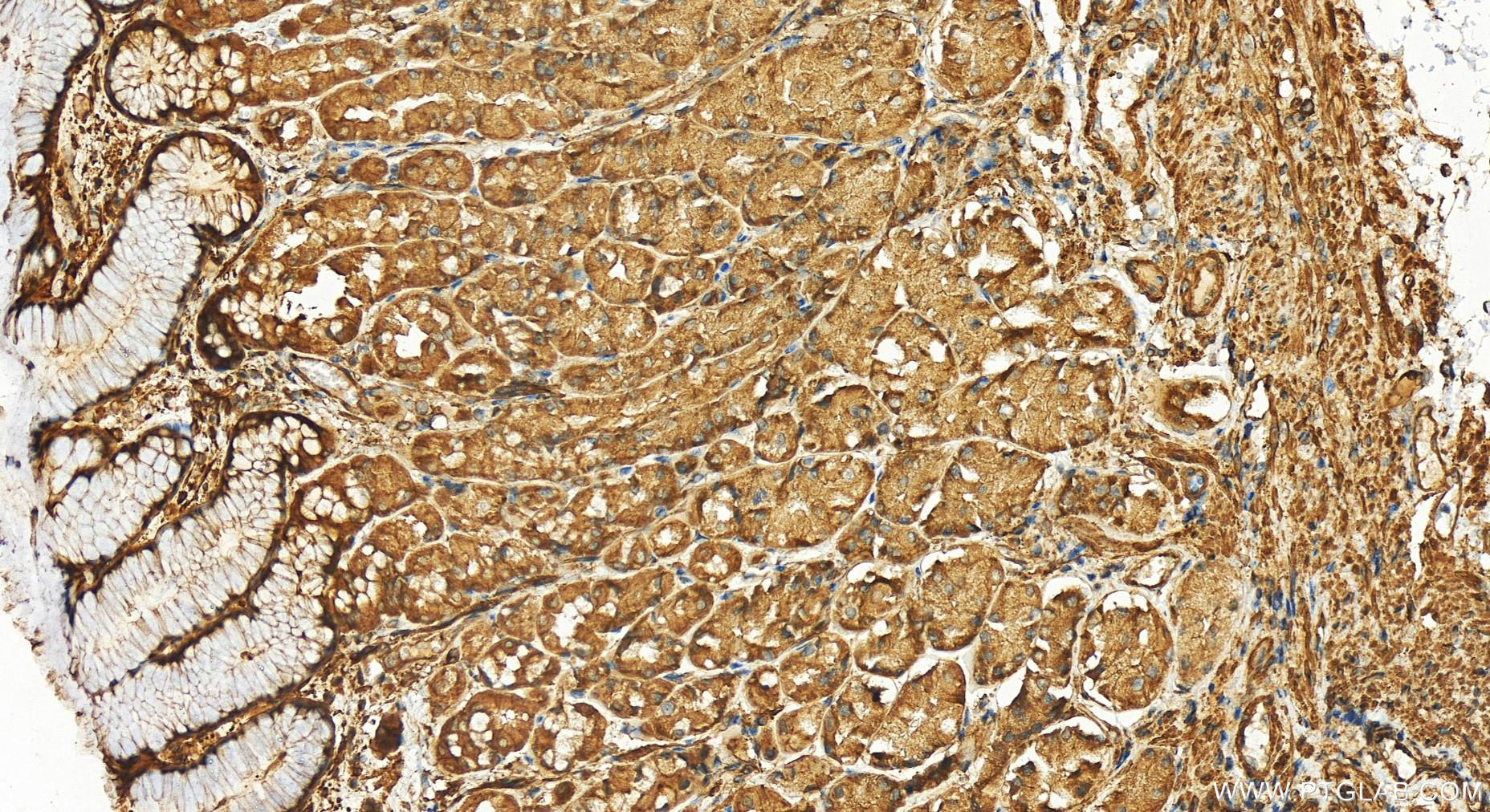 Immunohistochemistry (IHC) staining of human stomach tissue using PARVB Polyclonal antibody (14463-1-AP)