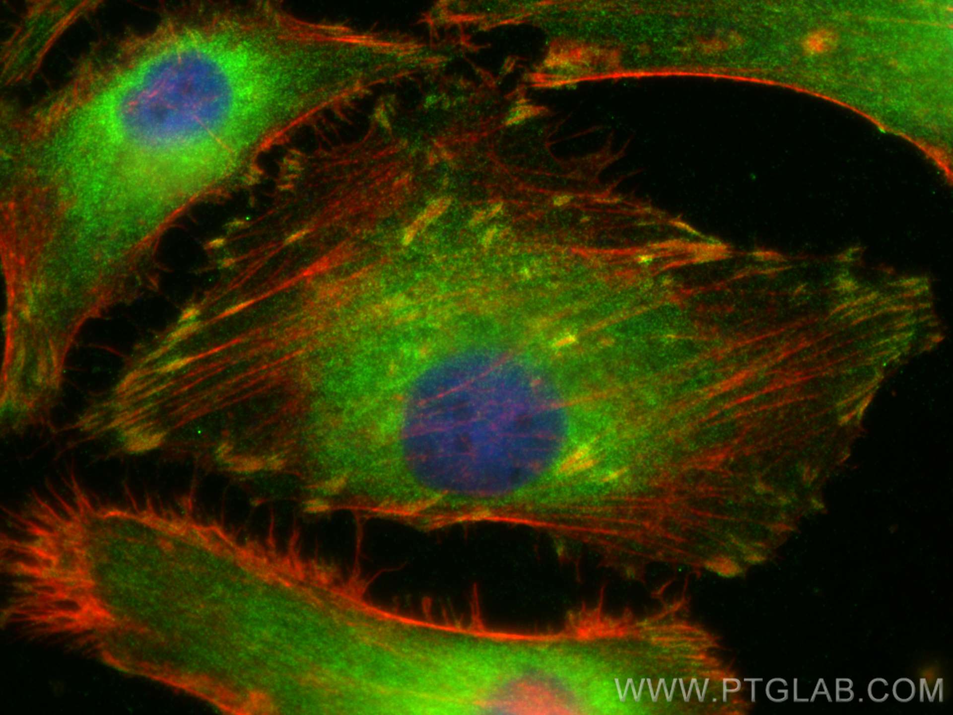 Immunofluorescence (IF) / fluorescent staining of HeLa cells using PARVB Polyclonal antibody (14463-1-AP)