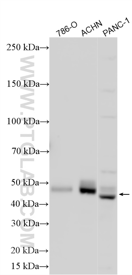 Western Blot (WB) analysis of various lysates using PAX2 Polyclonal antibody (29307-1-AP)