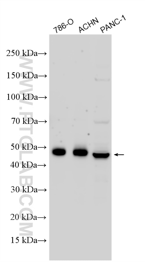 Western Blot (WB) analysis of various lysates using PAX2 Polyclonal antibody (29307-1-AP)