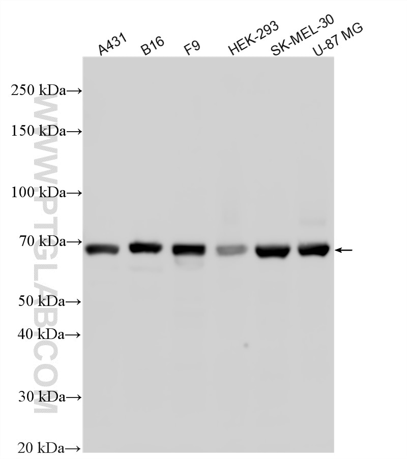 Western Blot (WB) analysis of various lysates using PAX3 Polyclonal antibody (21386-1-AP)