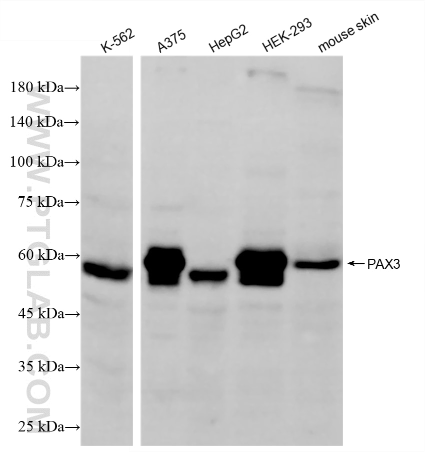Western Blot (WB) analysis of various lysates using PAX3 Recombinant monoclonal antibody (87980-1-RR)