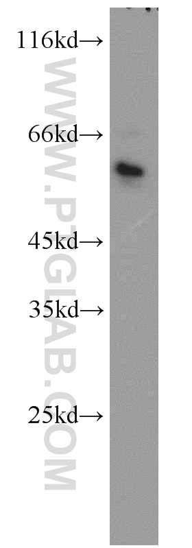 Western Blot (WB) analysis of HeLa cells using PAX4 Polyclonal antibody (21387-1-AP)