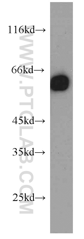 Western Blot (WB) analysis of Jurkat cells using PAX4 Polyclonal antibody (21387-1-AP)