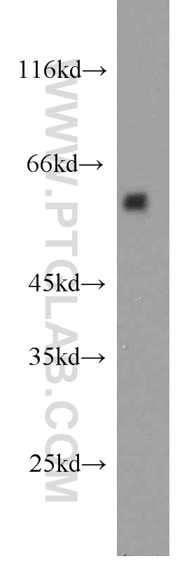 Western Blot (WB) analysis of mouse pancreas tissue using PAX4 Polyclonal antibody (21387-1-AP)