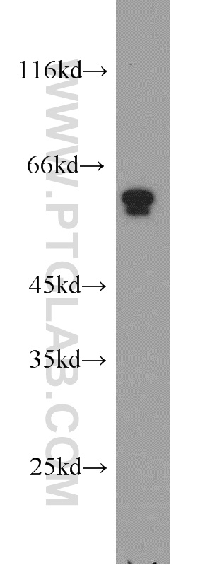 Western Blot (WB) analysis of COLO 320 cells using PAX4 Polyclonal antibody (21387-1-AP)