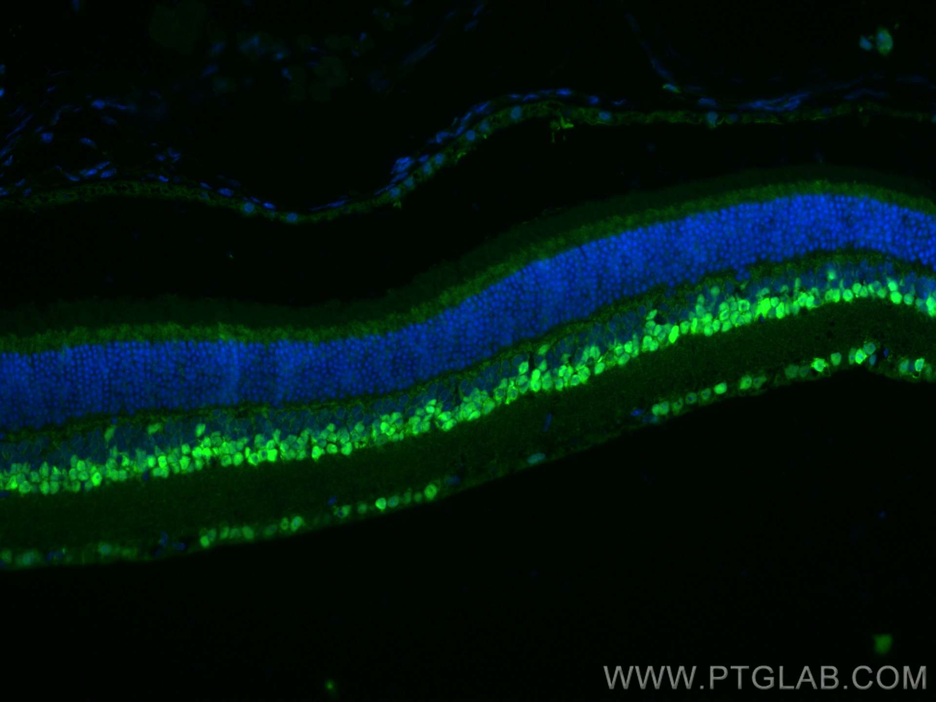 Immunofluorescence (IF) / fluorescent staining of mouse eye tissue using PAX6 Polyclonal antibody (12323-1-AP)