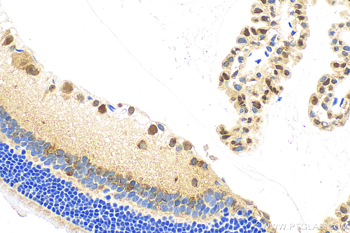 Immunohistochemistry (IHC) staining of rat eye tissue using PAX6 Polyclonal antibody (12323-1-AP)