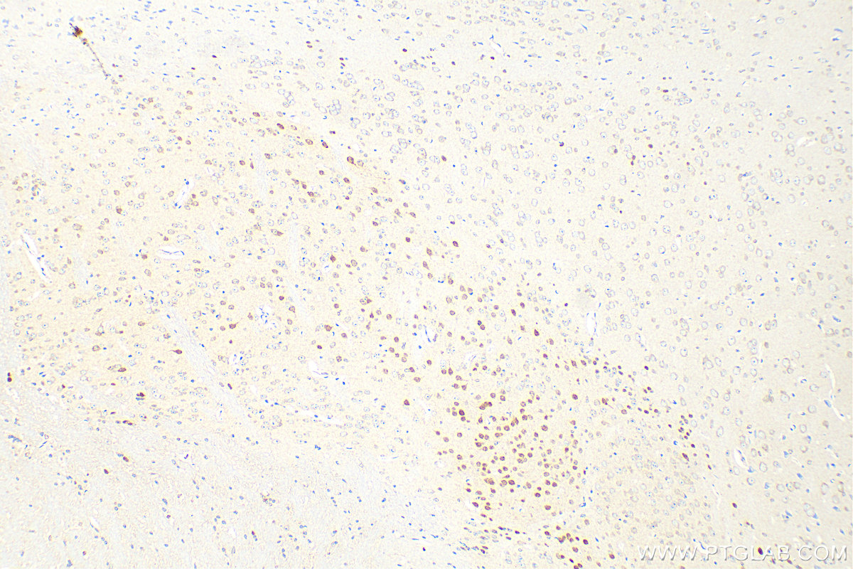 Immunohistochemistry (IHC) staining of mouse brain tissue using PAX6 Polyclonal antibody (12323-1-AP)