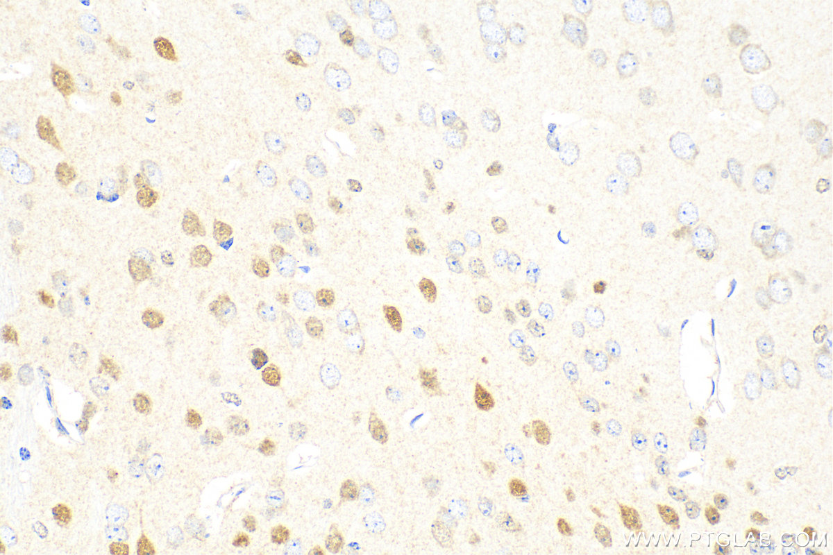 Immunohistochemistry (IHC) staining of mouse brain tissue using PAX6 Polyclonal antibody (12323-1-AP)