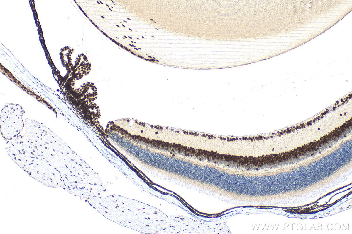Immunohistochemistry (IHC) staining of mouse eye tissue using PAX6 Polyclonal antibody (12323-1-AP)