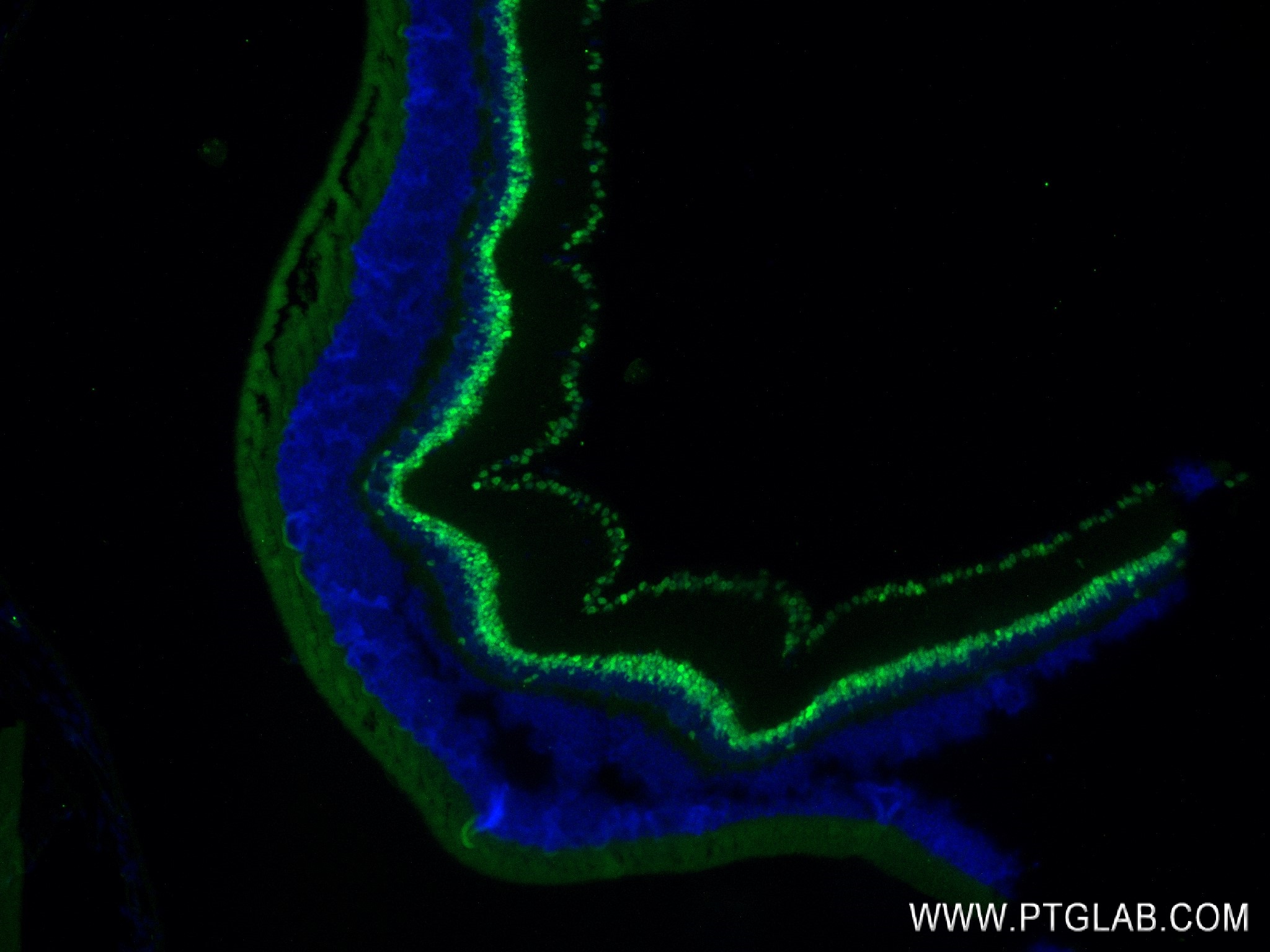 Immunofluorescence (IF) / fluorescent staining of mouse eye tissue using PAX6 Recombinant antibody (84345-5-RR)