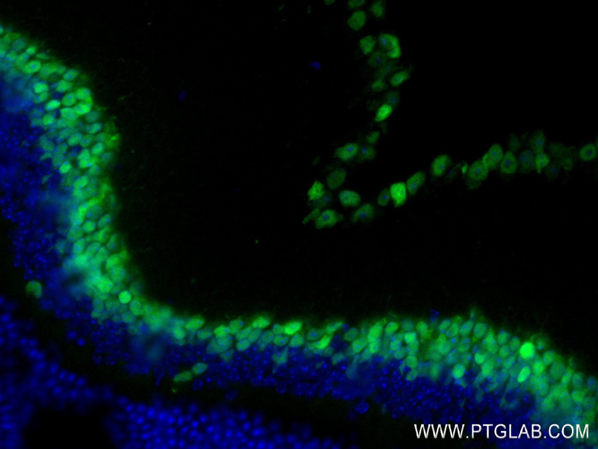 Immunofluorescence (IF) / fluorescent staining of mouse eye tissue using PAX6 Recombinant antibody (84345-5-RR)