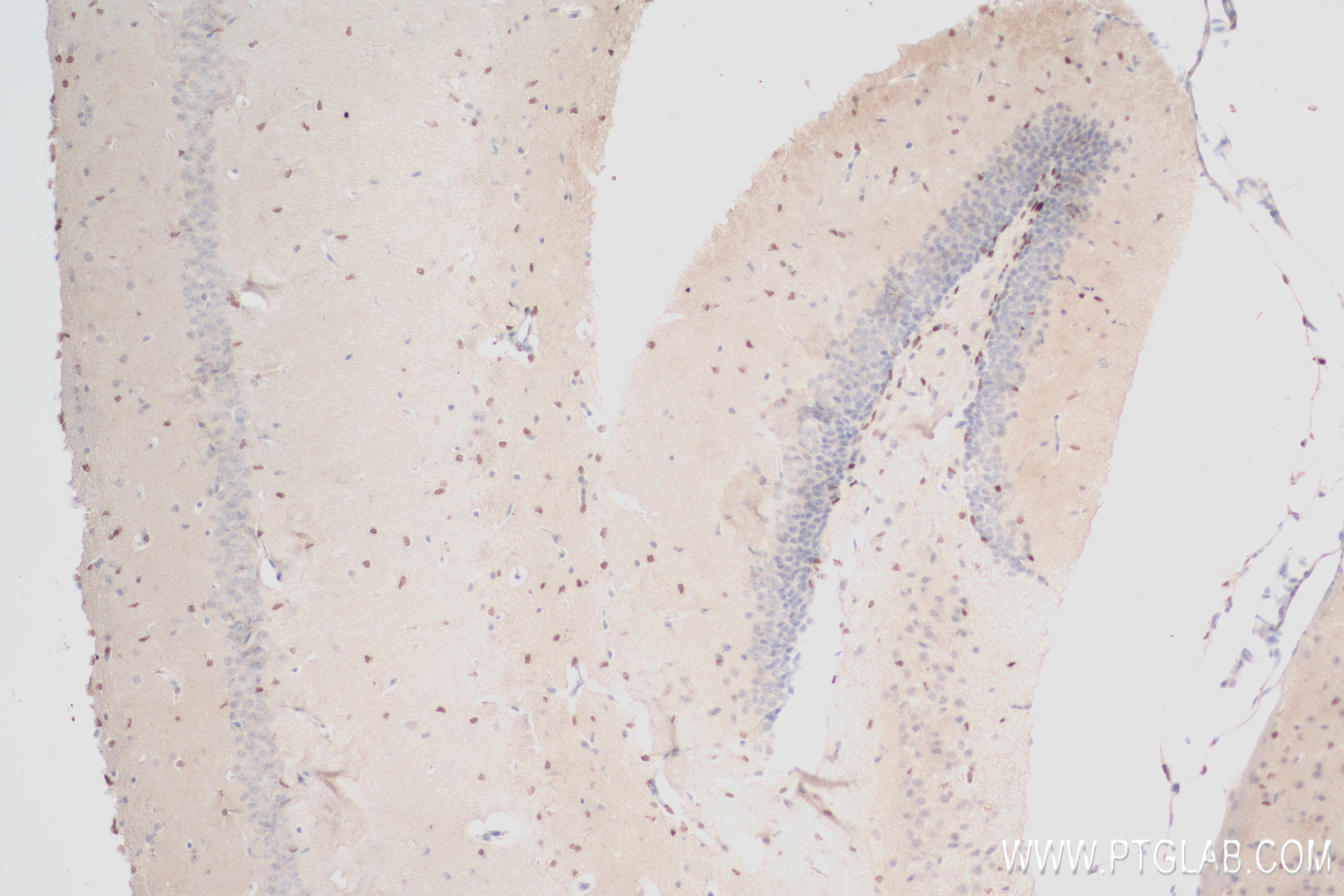 Immunohistochemistry (IHC) staining of mouse brain tissue using PAX6 Recombinant antibody (84345-5-RR)