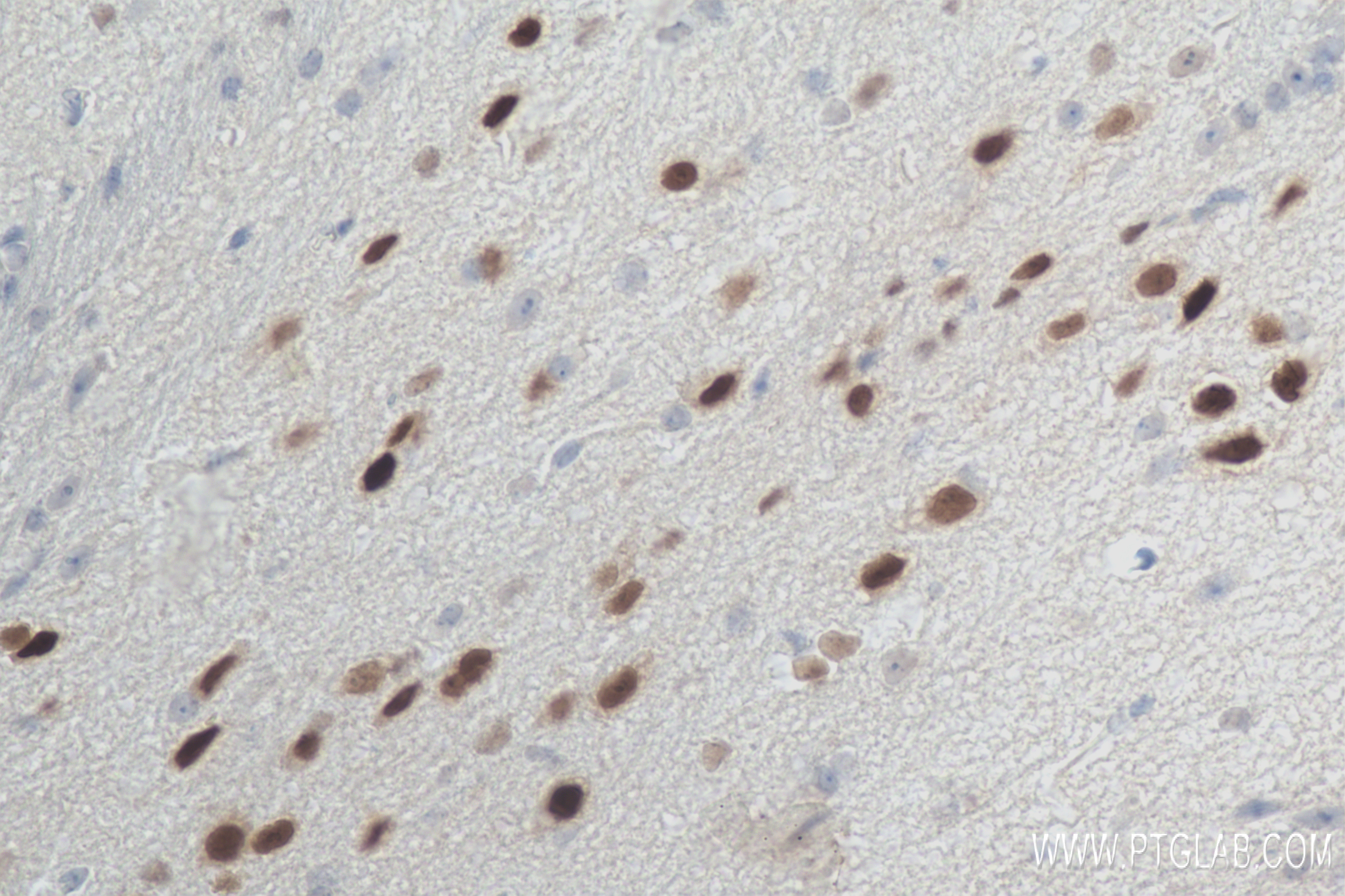 Immunohistochemistry (IHC) staining of mouse brain tissue using PAX6 Recombinant antibody (84345-5-RR)