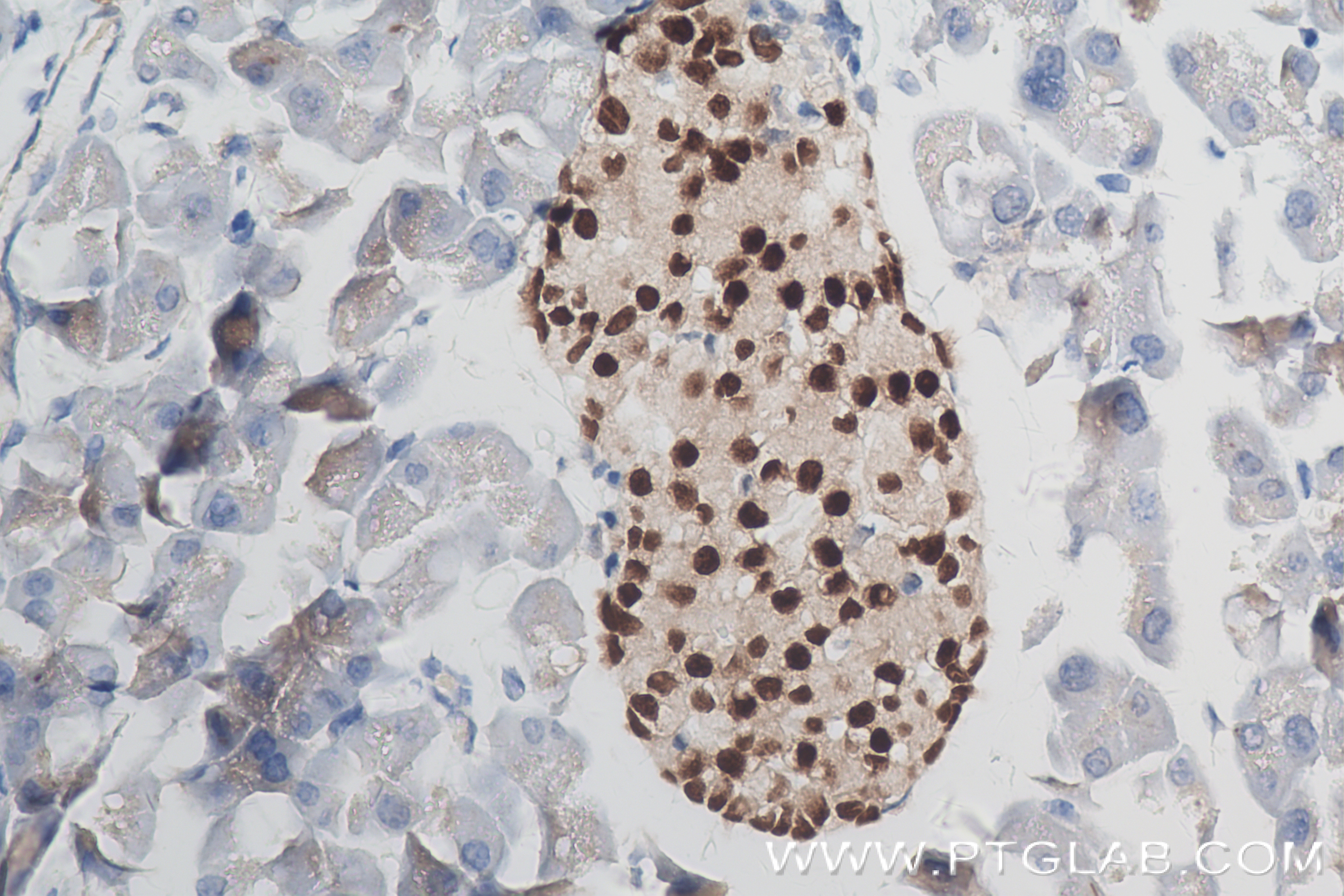 Immunohistochemistry (IHC) staining of mouse pancreas tissue using PAX6 Recombinant antibody (84345-5-RR)