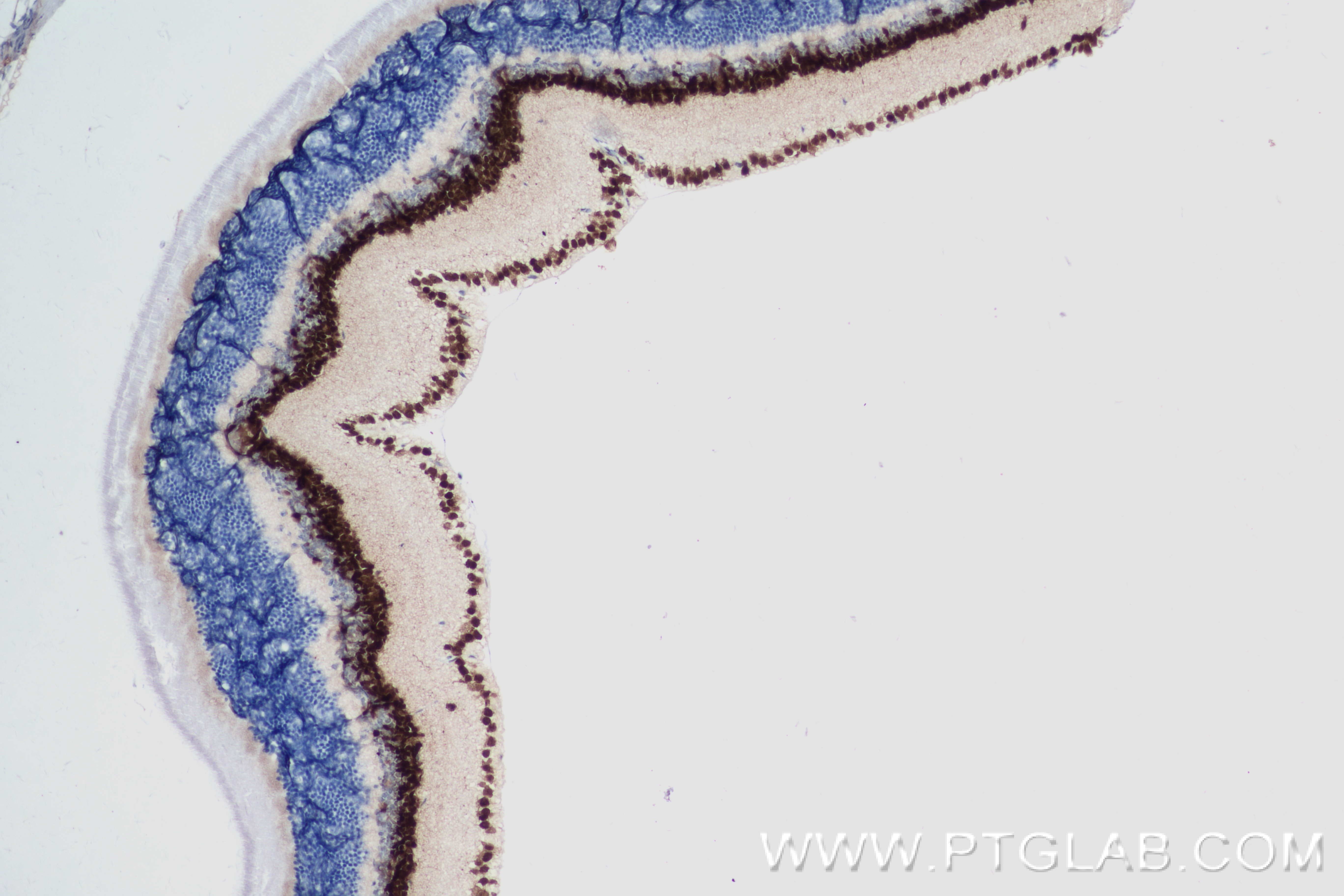 Immunohistochemistry (IHC) staining of mouse eye tissue using PAX6 Recombinant antibody (84345-5-RR)