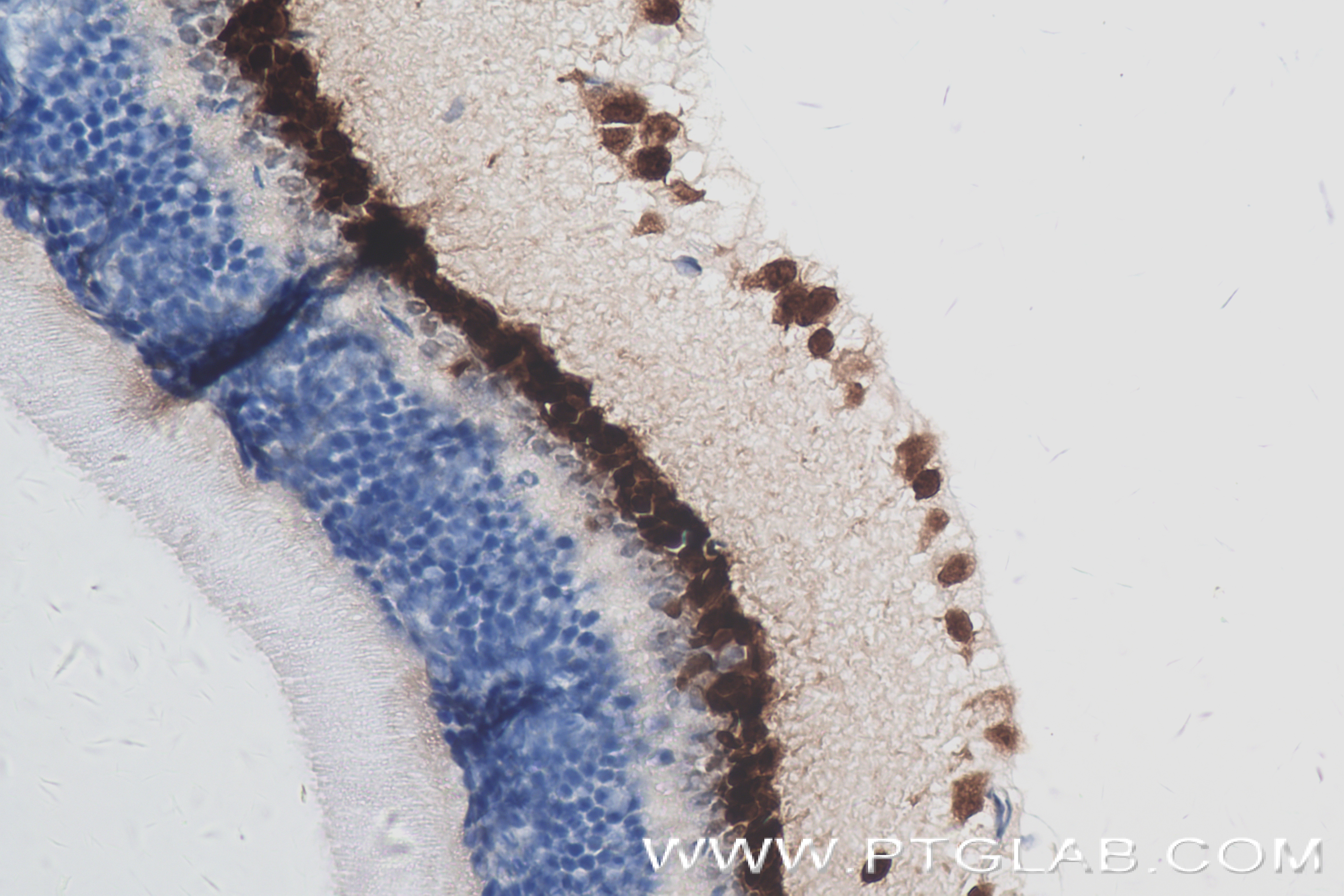 Immunohistochemistry (IHC) staining of mouse eye tissue using PAX6 Recombinant antibody (84345-5-RR)