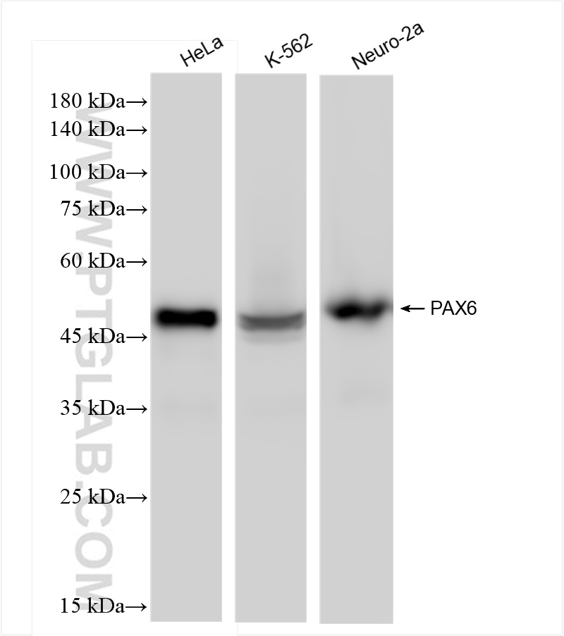 Western Blot (WB) analysis of various lysates using PAX6 Recombinant antibody (84345-5-RR)