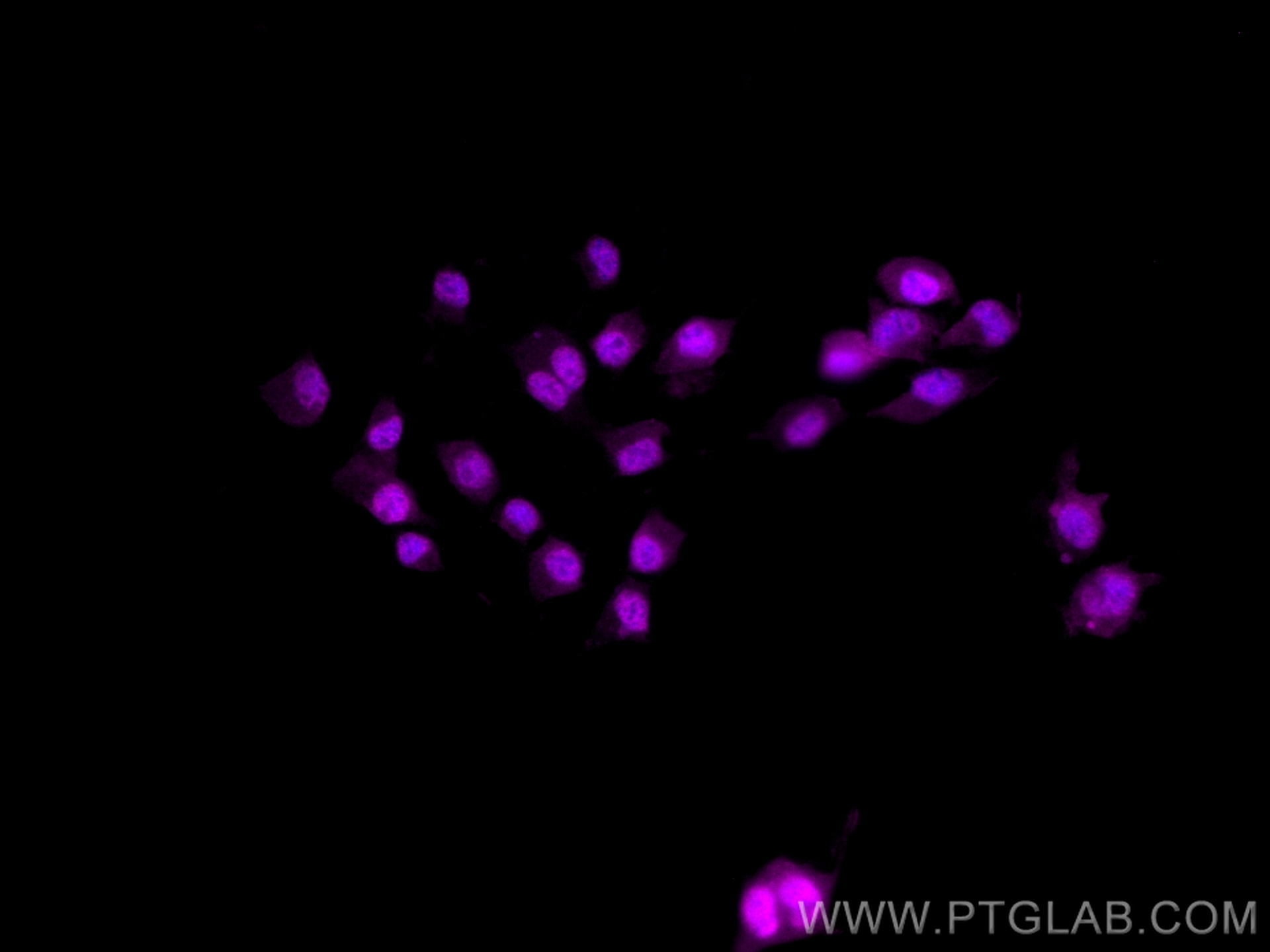 Immunofluorescence (IF) / fluorescent staining of Neuro-2a cells using CoraLite® Plus 647-conjugated PAX6 Polyclonal anti (CL647-12323)