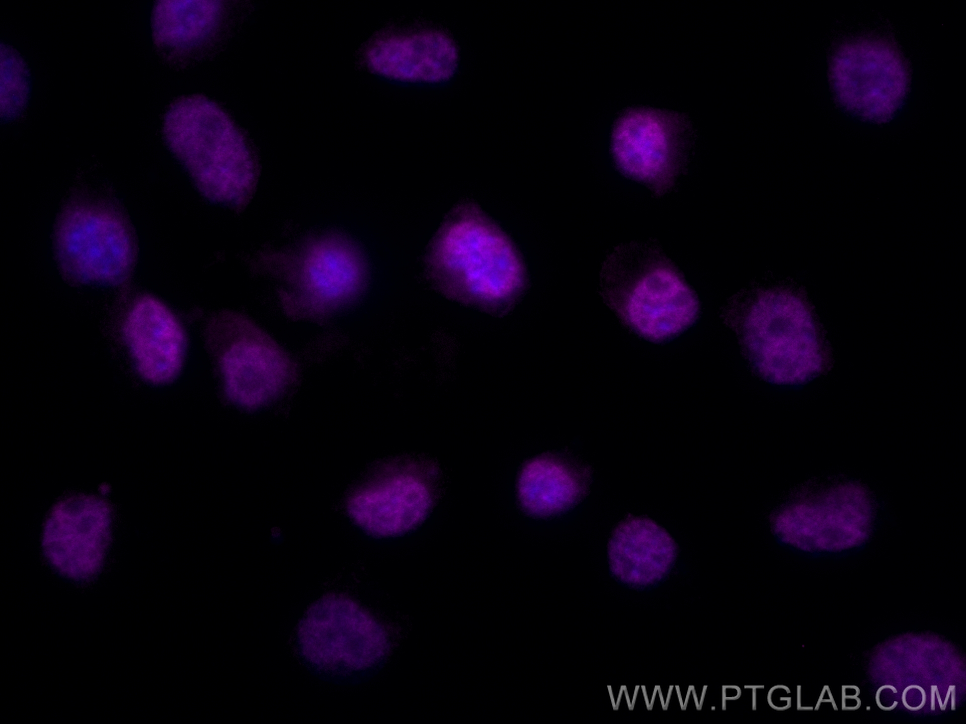 Immunofluorescence (IF) / fluorescent staining of Neuro-2a cells using CoraLite® Plus 647-conjugated PAX6 Polyclonal anti (CL647-12323)