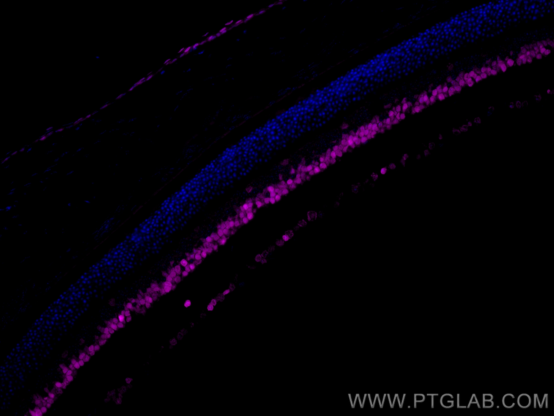 Immunofluorescence (IF) / fluorescent staining of mouse eye tissue using CoraLite® Plus 647-conjugated PAX6 Polyclonal anti (CL647-12323)