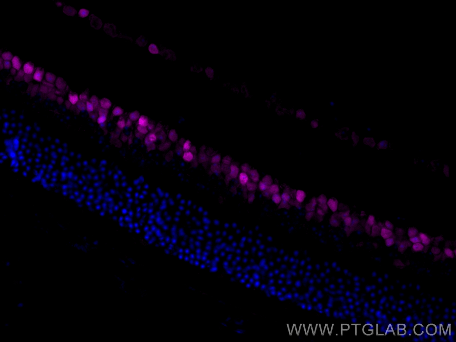 Immunofluorescence (IF) / fluorescent staining of mouse eye tissue using CoraLite® Plus 647-conjugated PAX6 Polyclonal anti (CL647-12323)