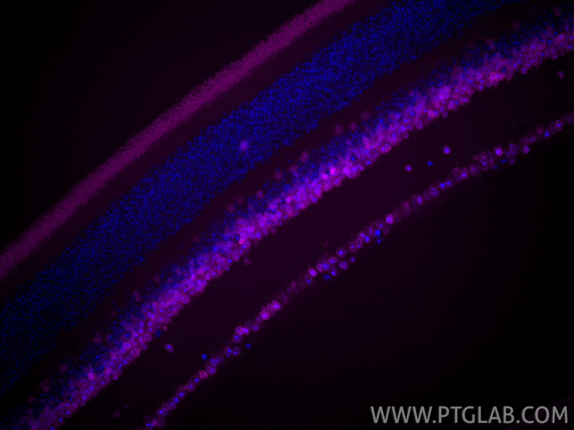 Immunofluorescence (IF) / fluorescent staining of mouse eye tissue using CoraLite® Plus 647-conjugated PAX6 Recombinant mon (CL647-84345-5)