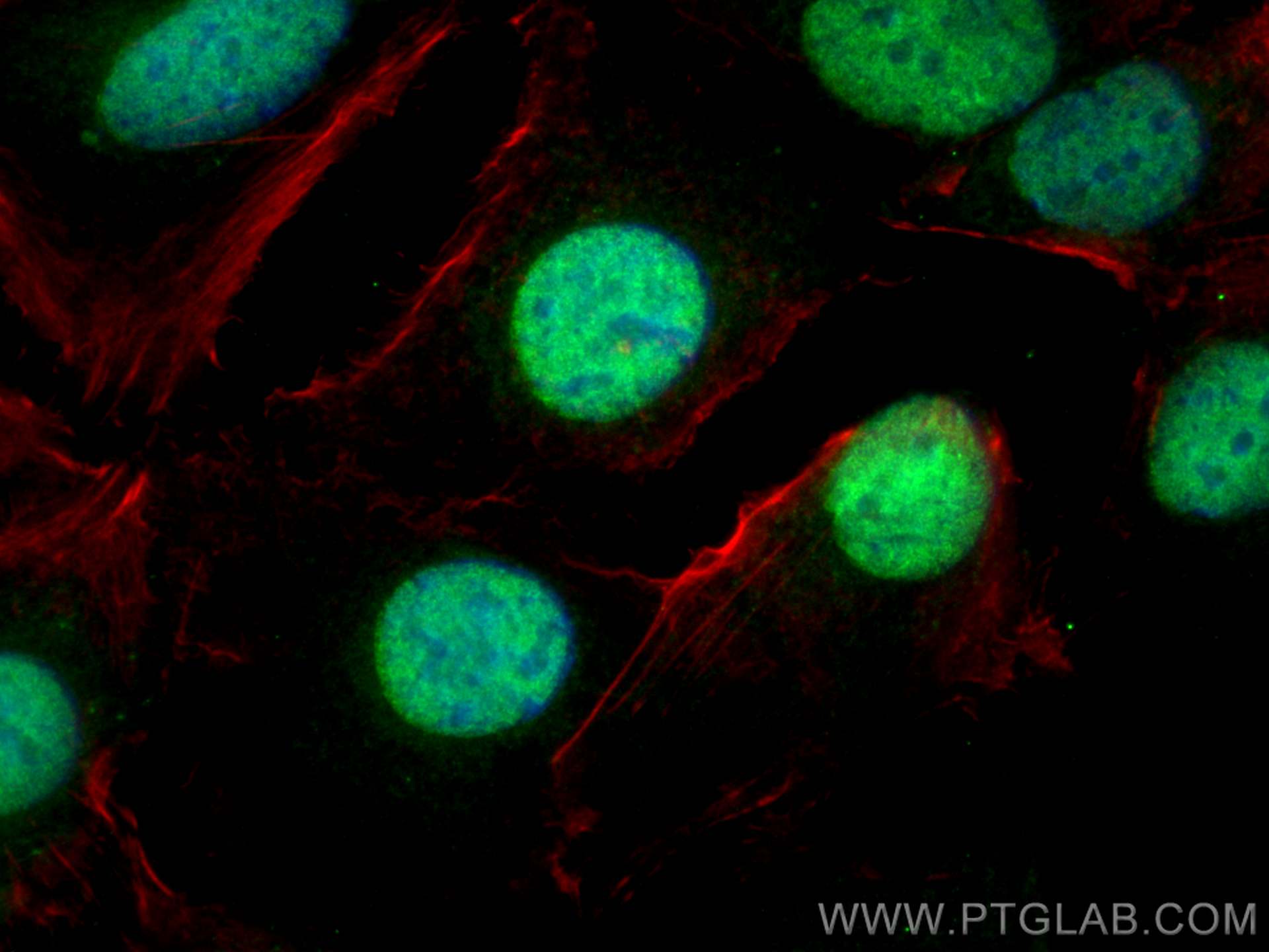 Immunofluorescence (IF) / fluorescent staining of SKOV-3 cells using PAX8 Polyclonal antibody (10336-1-AP)